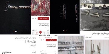 فروش لوازم دست دوم ارتوپدی در فضای مجازی/ لوازم دست دوم «ارتوپدی» قابل استفاده نیست