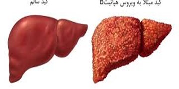 چطور هپاتیت «C»  را درمان کنیم؟