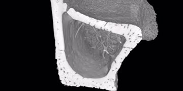 کشف عروق خونی بسیار ریز در داخل استخوان‌ها