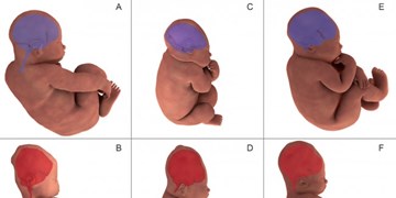 تصویربرداری سه بعدی تغییرات سر جنین را مشخص کرد