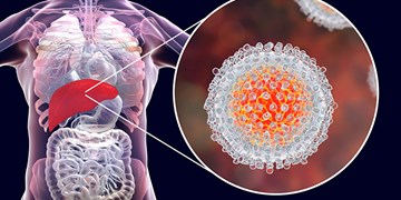 بیماران هپاتیت C در معرض خطر ابتلا به پارکینسون