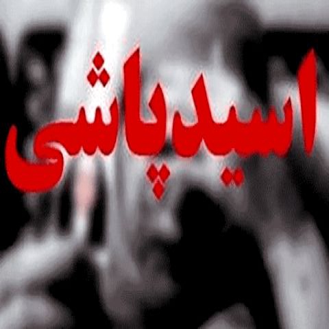 اینبار در کاشمر؛ زن ۳۵ ساله قربانی اسید پاشی