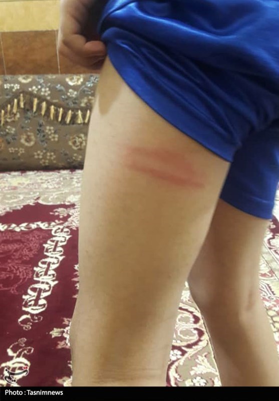 ‌جزئیات تنبیه بدنی دانش‌آموزان یکی از مدارس بندرماهشهر توسط ناظم