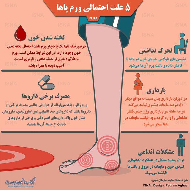 پنج علت احتمالی ورم پاها