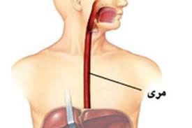 بیماری وحشتناک که مری را از بین می‌برد + عکس