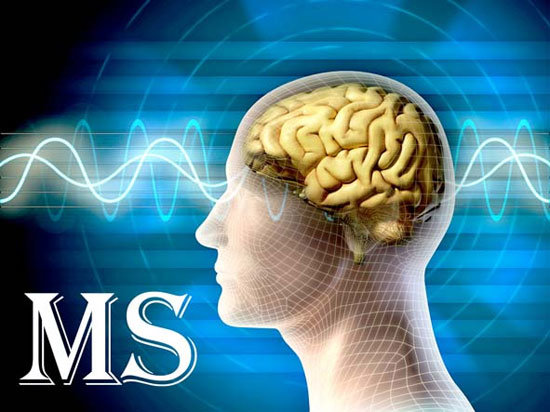 سلول‌های بنیادی، کلید درمان بیماری MS