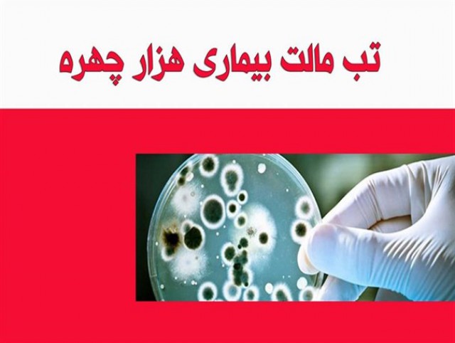 ابتلای 520 نفر به تب مالت در نیشابور / آمار تب مالت رو به افزایش است